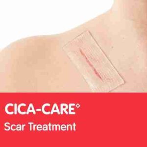 Cica Scar Treatment 3cm X 12cm 1 Pack