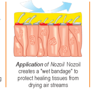 2* Flo Nozoil Spray 15ml - Image 4