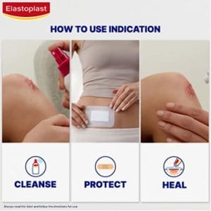 Elastoplast Dressing Green And Protect Extra Strong Adhesion Dressing 1 M X 6 cm Size Beige - Image 5